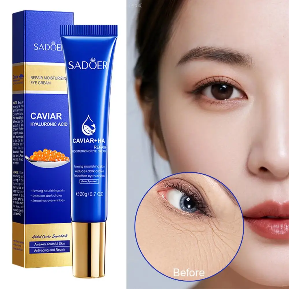 1/2/3pcs SADOER Caviar Hyaluronic Acid Eye Cream Anti Dark Circles Removal Eyes Bags anti-aging Moisturizing Eyes Skin Care - view 2