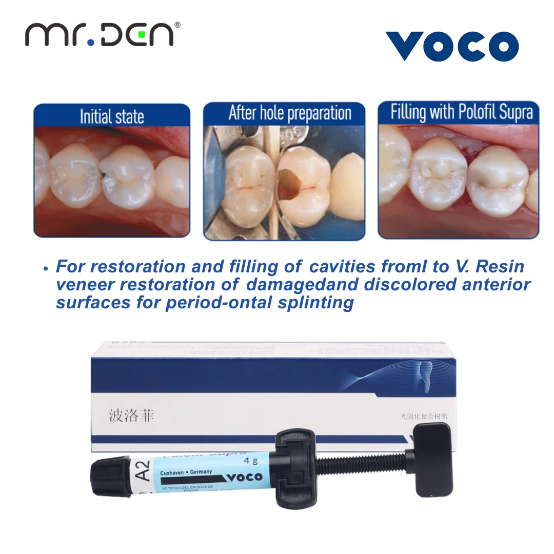 VOCO Polofil Supra Nano Universal Light Curing Resin Dental Material for Front & Rear Teeth Repair