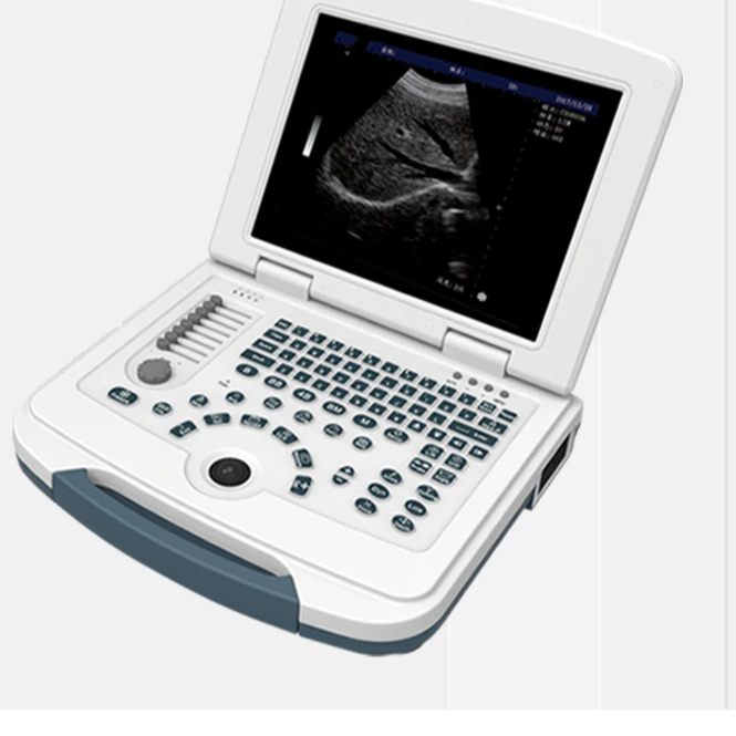 High quality ultrasound EQUIPMENT manufacturer sonography Echocardiography portable ultrasound machine price