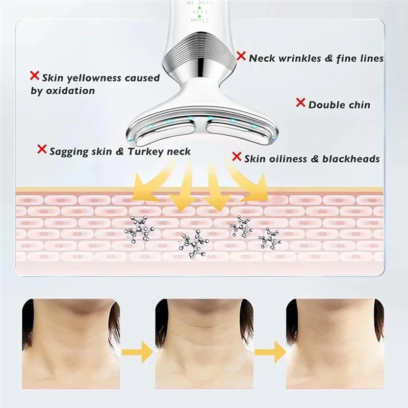 Dispositivo de beleza para pescoço, massageador cervical, multifuncional, ferramenta de massagem no pescoço para alívio de pescoço e remoção de dobras nasolabiais