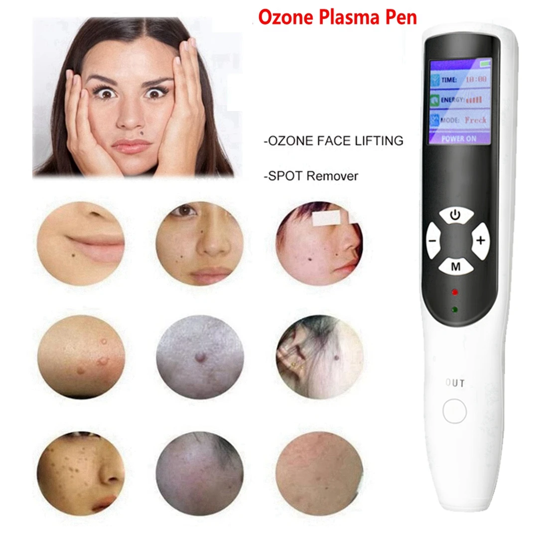 

New Ozone Fibroblast PAA Plasma Pen For Eyelid Face Lifting Wrinkle Spot Mole Freckle Removal Skin Care Equipment