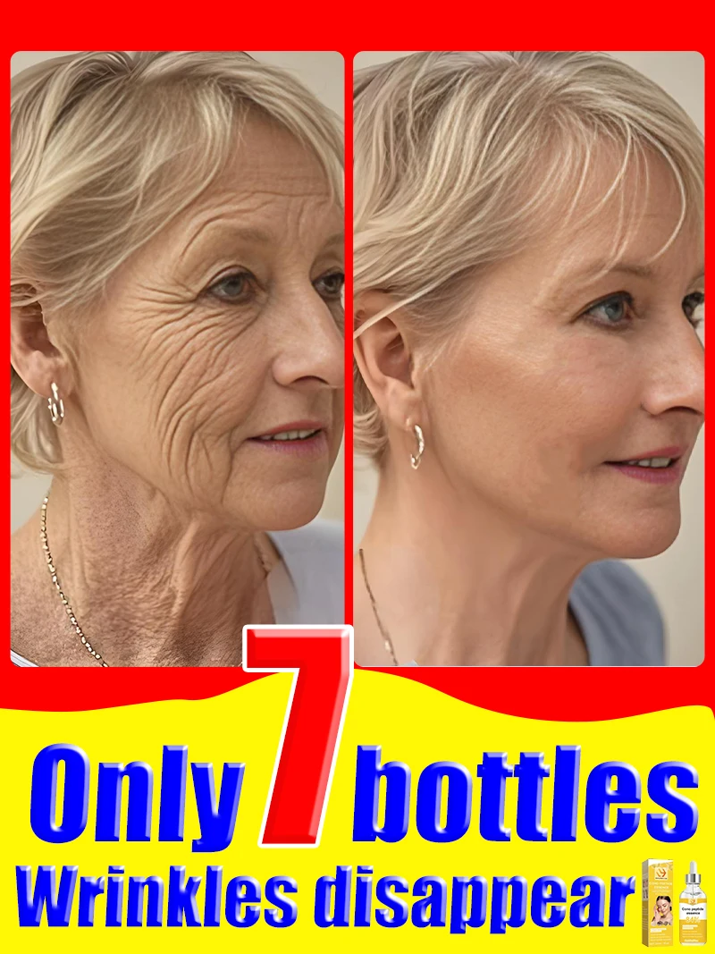 Wrinkles Free, For Deep Wrinkles