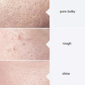 6ベストセールスケミカルピールピーリング-5