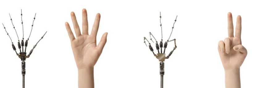 

Price difference payment for finger skeleton
