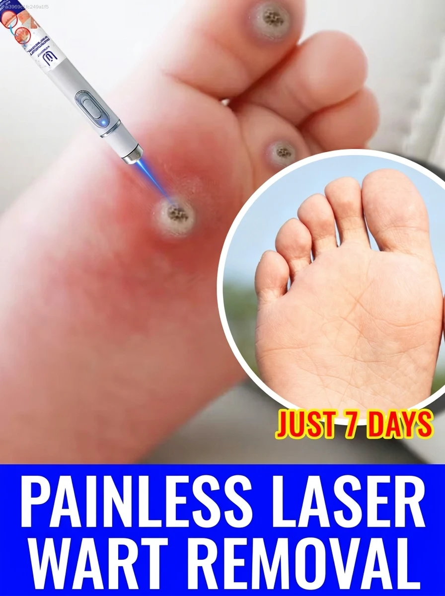 

Mini Lᴀsᴇʀ ᵂᵃʳᵗ ᴿᵉᵐᵒᵛᵉʳ Pᴇɴ - Painless & Efficient Removal, Essential for ᴰᵃⁱˡʸ Skin Care