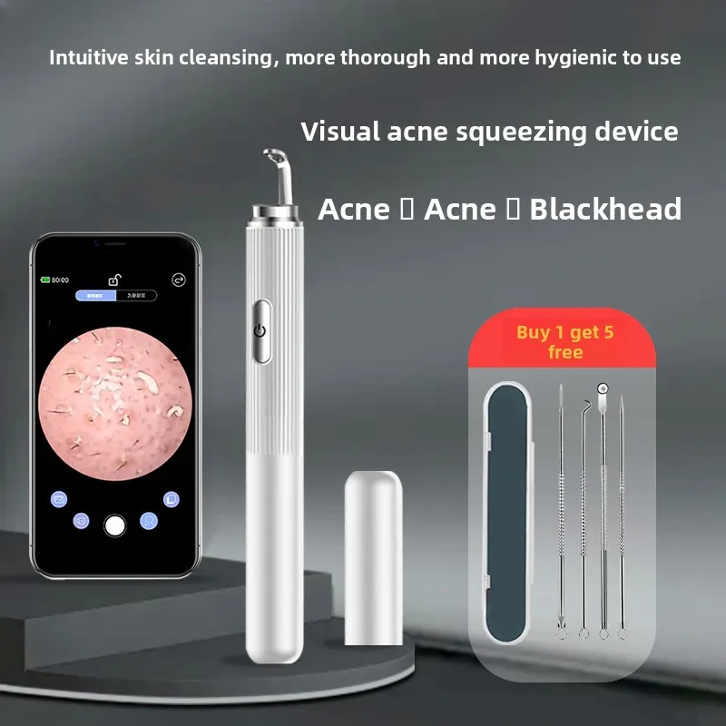 

50x Magnified Comedone Extractor, HD Visible Pimple Popping Tool, Precision Blackhead Removal & Stress Relief
