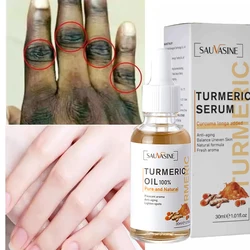 Dark Knuckle Whitening Set Turmeric Body Whiten Serum Remove Face Dark Spots Cream Brighten Hand Knuckle Elbow Knee Smooth Skin