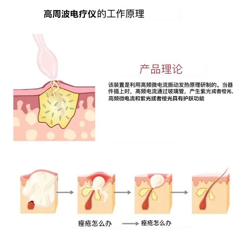 High Frequency Electrotherapy Device for Facial Acne Removal Ozone Acne Removal Beauty Device Scalp Sterilization Instrument