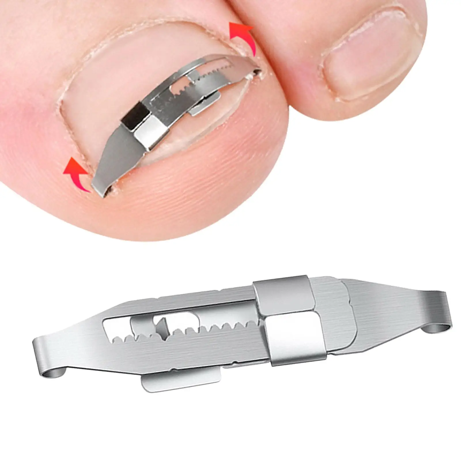 Ingrown Toenail Corrector Toenail Lifter Recover Top Grade Steel Foot Care