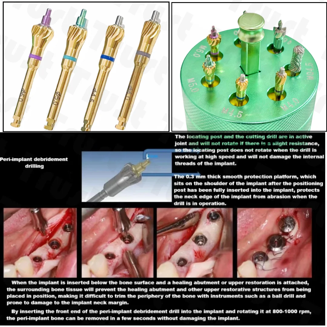 Dental Implant Bone Profiler Ridge Grinding Bur Surgical Instrument Contouring Drills Trimmer Collector GBR Surgical kit