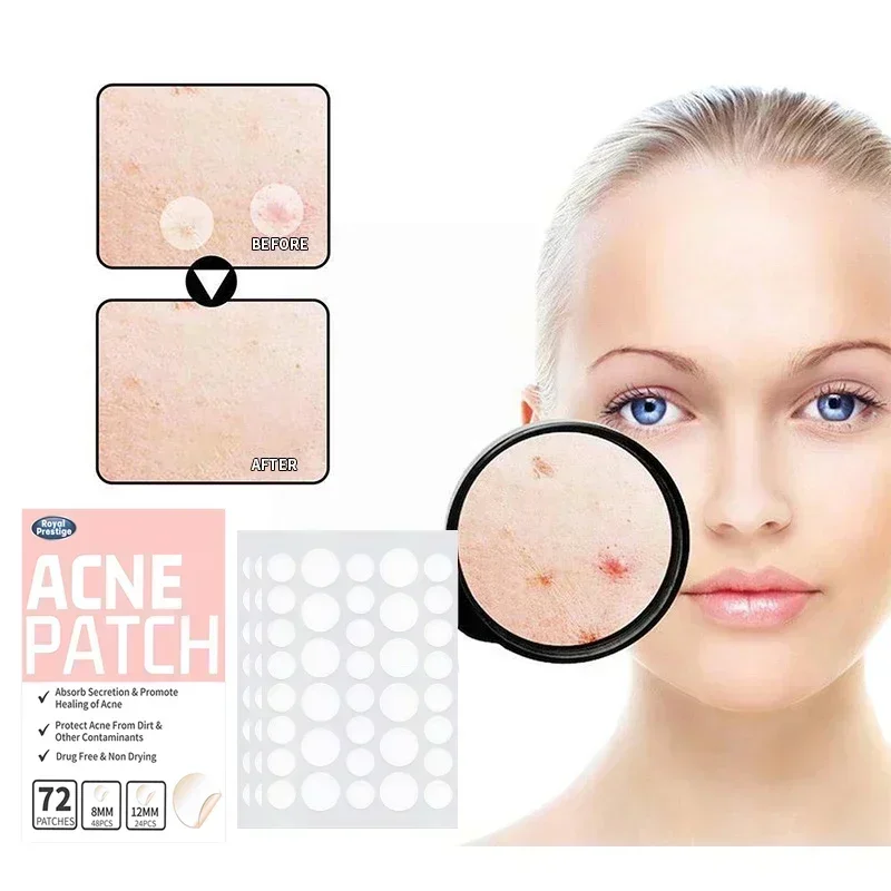 72/144Pcs Invisible Acne Patches Removal Pimple Anti-Acne Hydrocolloid Patches Spots Marks Concealer Repair Sticker Waterproof