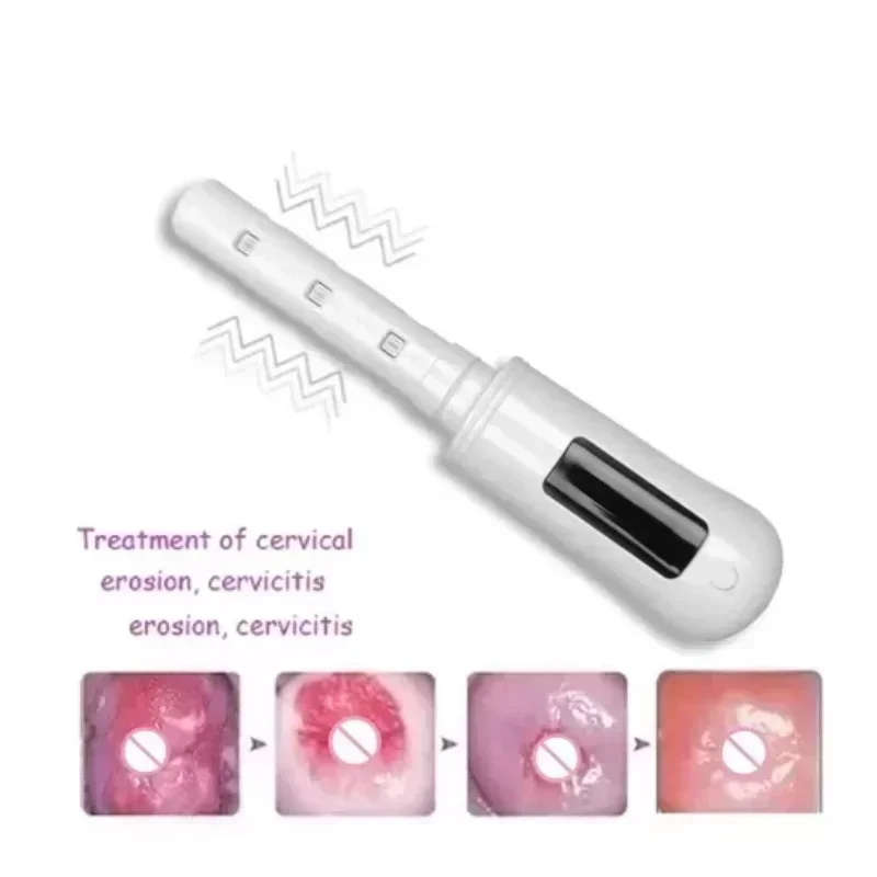 Mild Cervical Erosion Rehab Cold Laser Therapy Vaginitis Vaginal Rejuvenation Wand 650nm Red Blue Low Level Laser Device LLLT