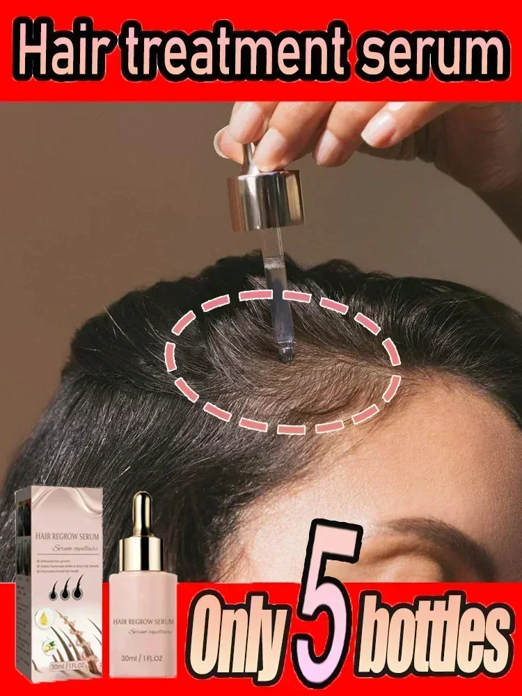 Crescimento do cabelo para homens mulheres evitar produtos de perda de cabelo óleos essenciais gengibre anti perda de cabelo óleo de tratamento do couro cabeludo