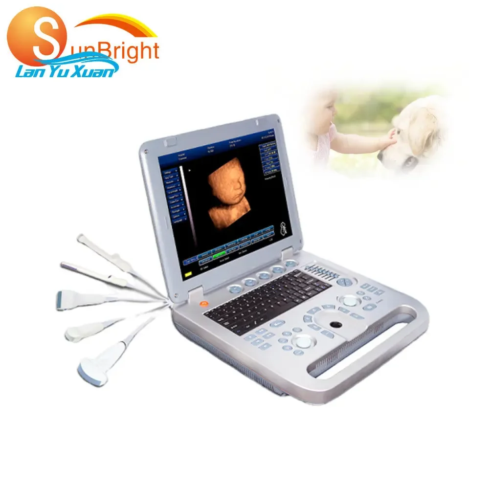 

SUN-800D Hot Selling Portable Animals Ultrasound Pc Based Usg Veterinary Ultrasound Scanning