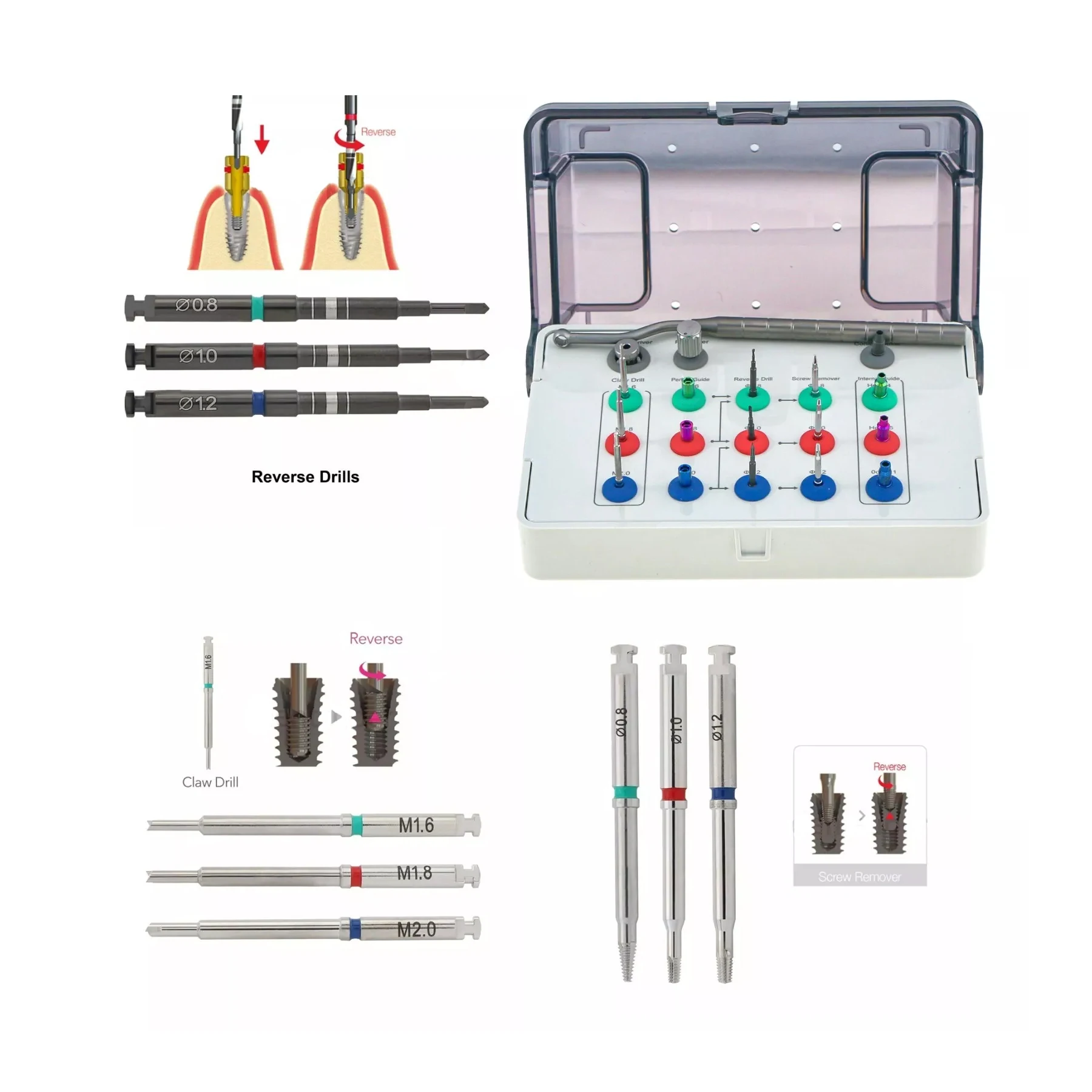 Dental Implant NeoBiotech SR Universal Broken Fractured Screw Remover Kit Upgraded Model