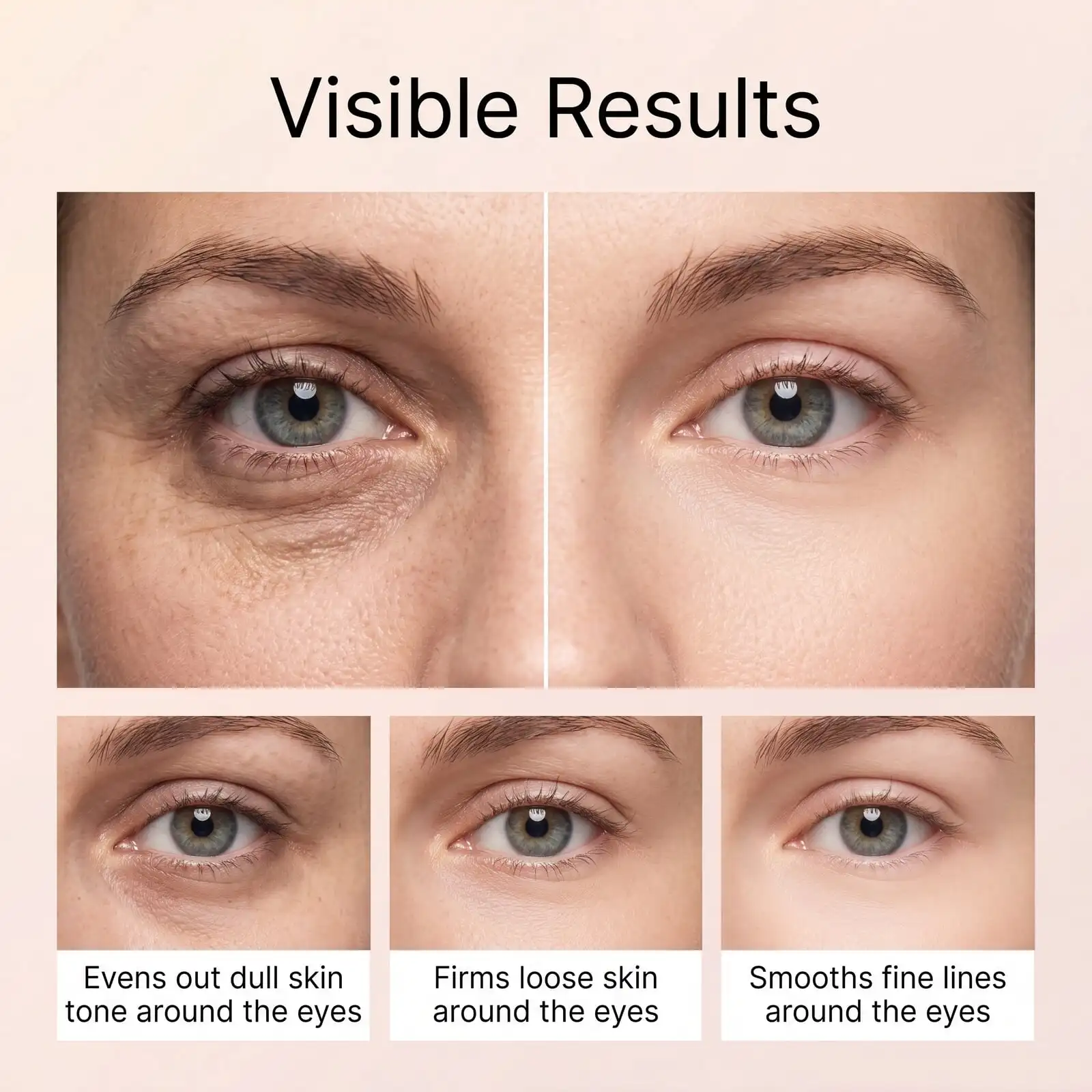 PDRN Volume Fill Booster Cream For Forehead,Smile Lines & Neck Wrinkles Reduction,Plumping Firming Retinal Peptides Care Cream