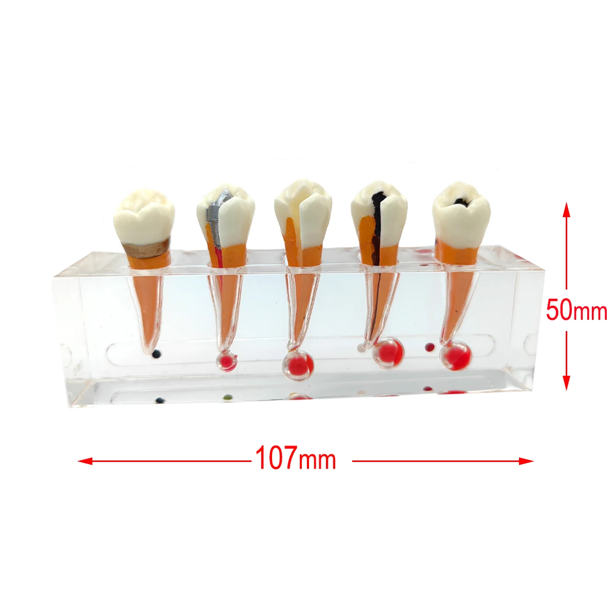 

Dental Teeth Model Dentist Student Model Endodontic Treatment Tooth Models M4007-2 For Dentistry Laboratory Patient Education