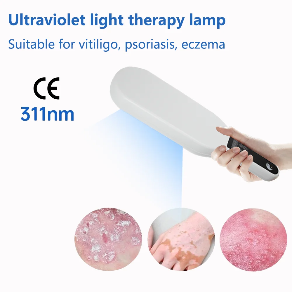 311nm Dubbele Buis Uvb Witiligo Psoriasis BehandelingLamp Fysiotherapie Eczeem Equioment Smalband Lampen Medische Lichtbron