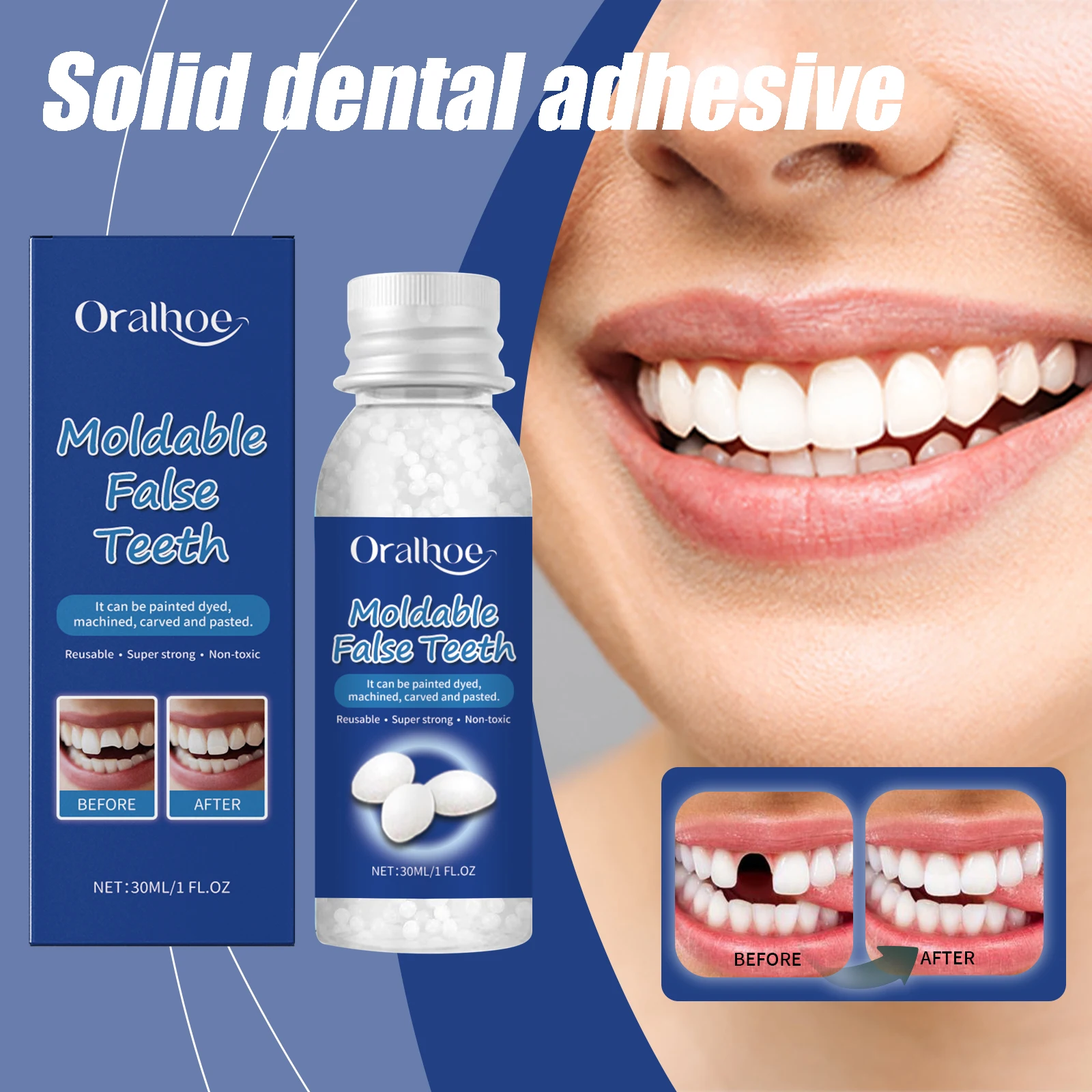 Adhesivo dental sólido de resina, moldeable, para rellenar espacios entre los dientes, pegamento sólido, reparación dental temporal, seguro, suministros de cuidado dental DIY, 30 ml