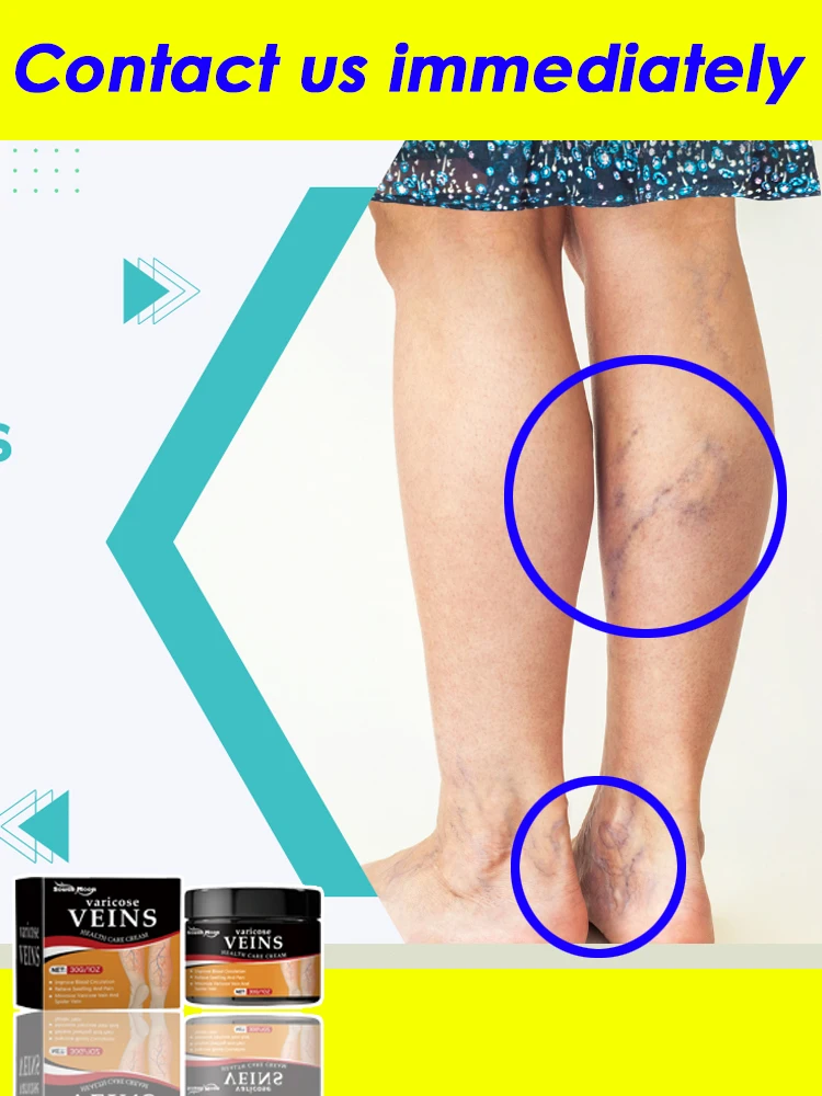 

2025 Hot sale Vein blue light tool, more discounts on sets Leg care tools say goodbye to varicose veins