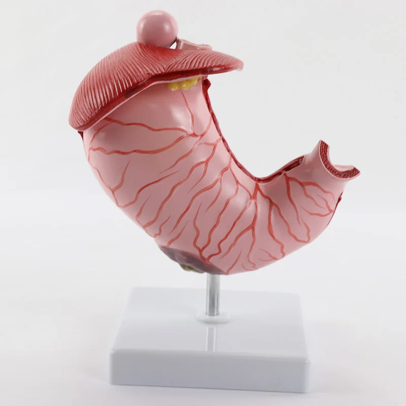 Diseased Stomach Model with Diaphragm Demonstration Anatomy Model Pathological Stomach Model