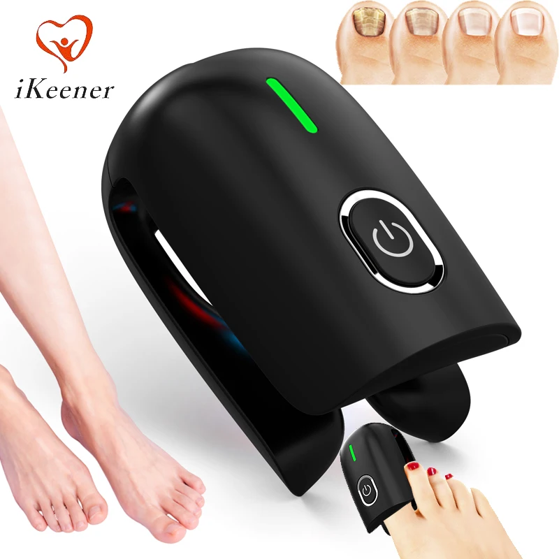 Dispositivo Láser para Hongos en las Uñas, Parches Correctores para Uñas de los Pies, Luz Azul de 470nm, Roja de 660nm, Infrarroja de 905nm, Onicomicosis, Antifúngico