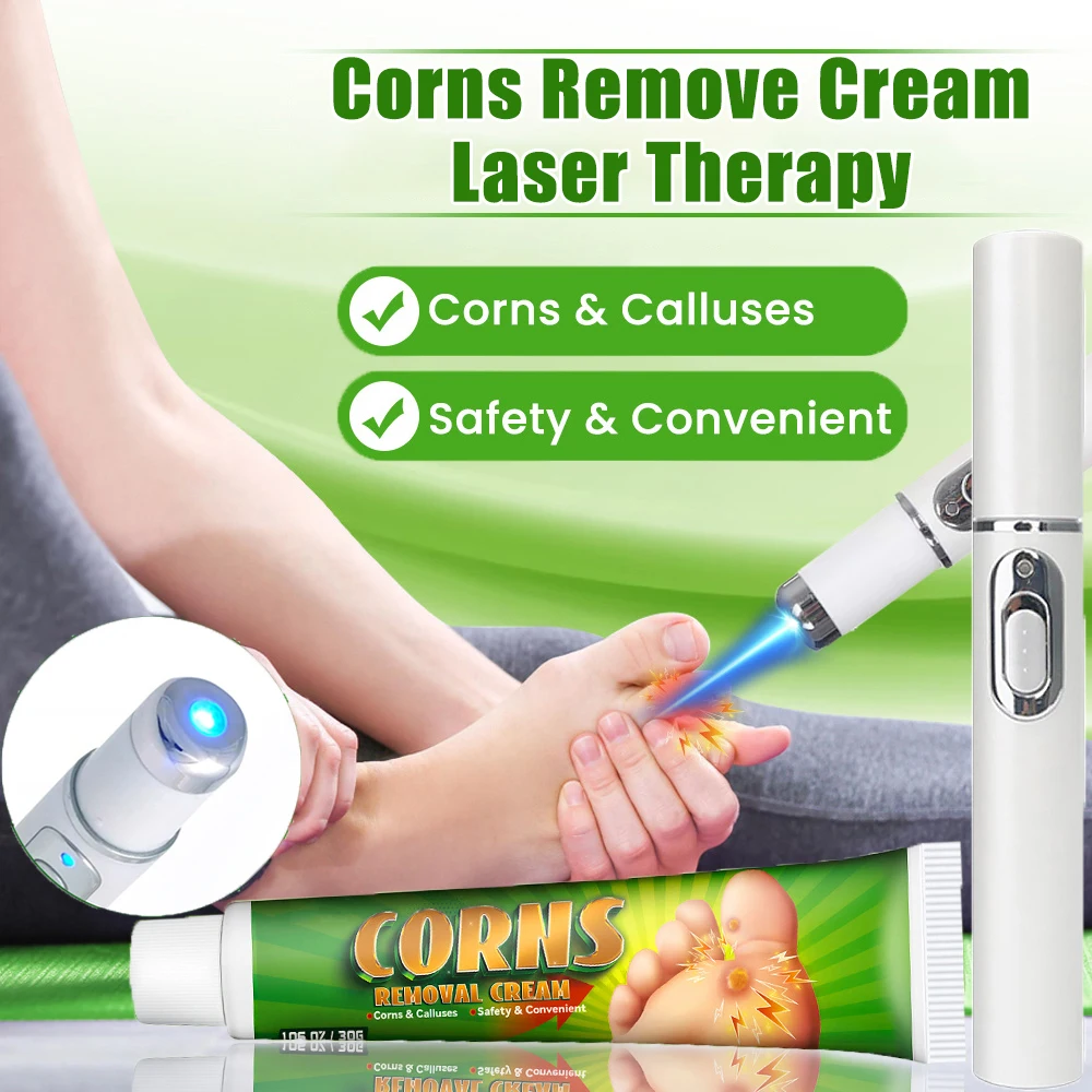 Corns Remove Cream Laser Therapy Chicken Eye Skin Infection Treatment Ointment Foot Dead Skin Calluses Removal Tools Health Care