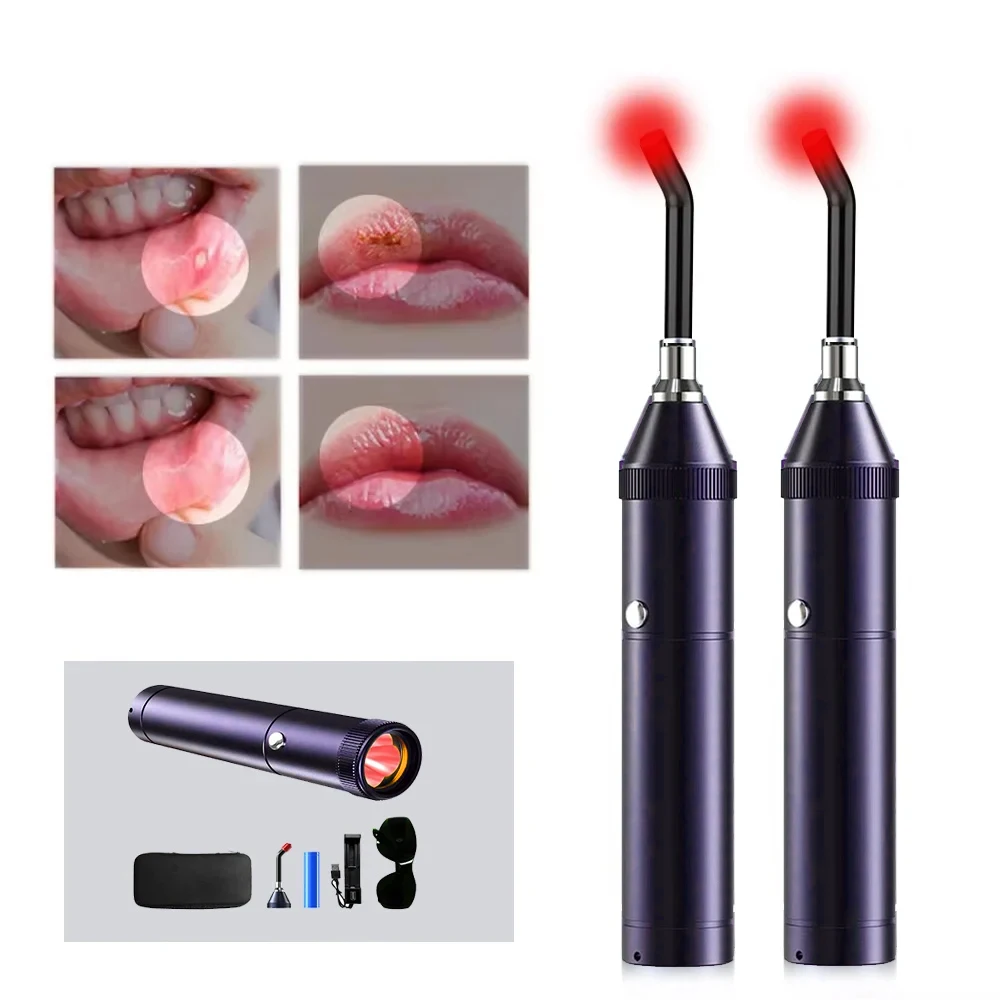 

Portable Dental Red Light Infrared Therapy Oral Ulcer Teeth Pain Sore Canker Lip Gingivitis Relief Laser Dental Tool