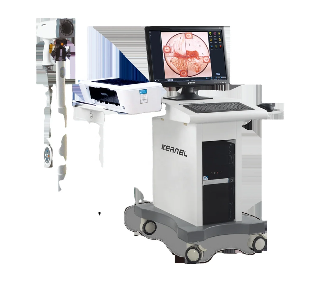 High Quality Colposcope Digital Imaging System Digital video Colposcope Imaging System for Vaginal Scope