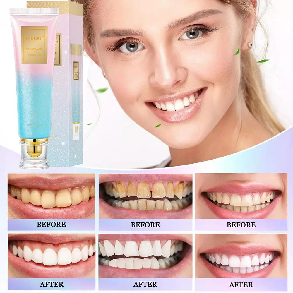 

Niacinamide Whitening Toothpaste Remove Smoke Stains Hygiene Cleaning Care Teeth Yellow Breath Fresh Products Oral Dental U0I5