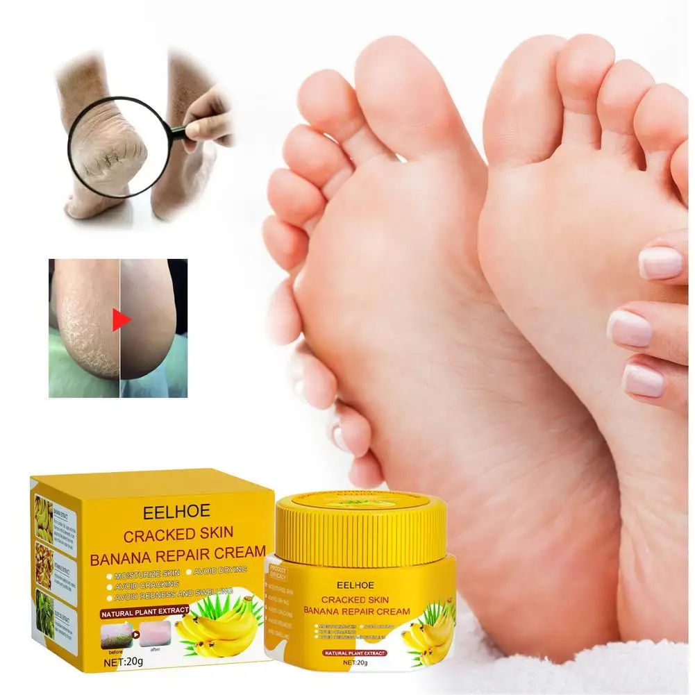

20g Natural Banana Oil Moisturizing Cracked Heel Balm Foot Hand Skin Repair Cream Anti-Drying Smooth Dead Skin Removal Ointment