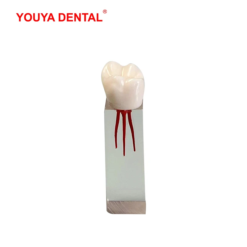 6 adet restorasyon diş eğitim modeli endodonti kök kanal blok reçine Endo diş modeli eğitim uygulama hamuru boşluğu RCT