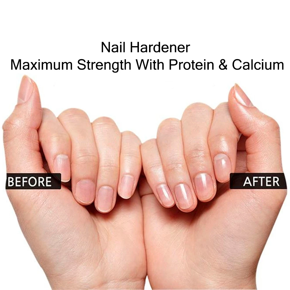 KODIES เจล Professional Nail Hardener น้ำมัน12ML สุขภาพความงามเล็บน้ำมัน Strengthener สำหรับปกป้องเล็บเท้านิ้วมือ