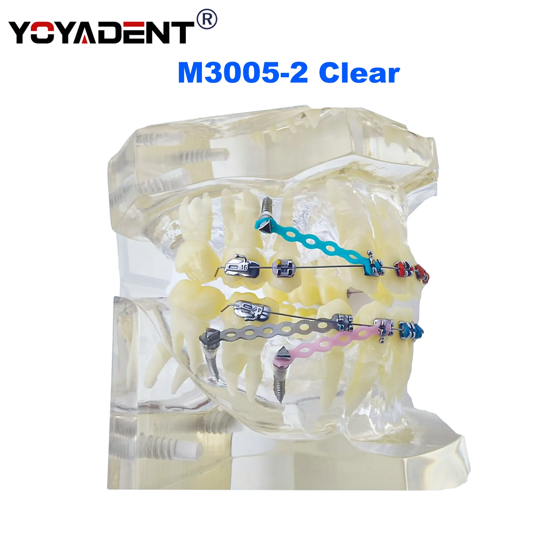 Dental Model Orthodontic Teeth Model  Metal Arch Wires Ties/ Ceramic Brackets  Orthodontic Correction Teaching