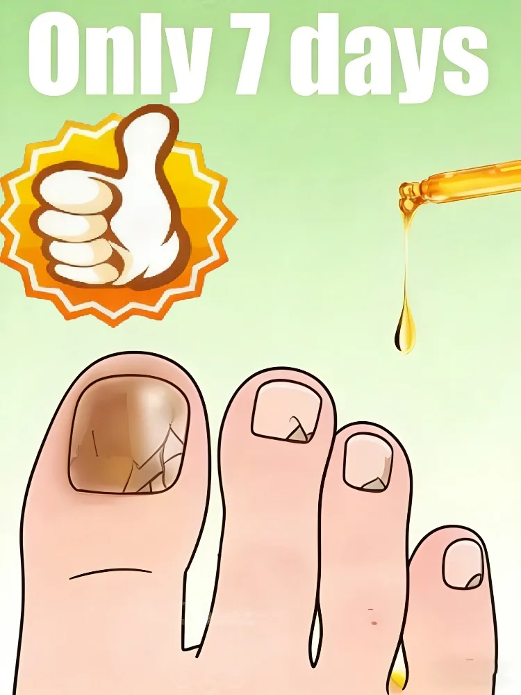 

7-дневное восстановление маникюра: забудьте о поврежденных ногтях