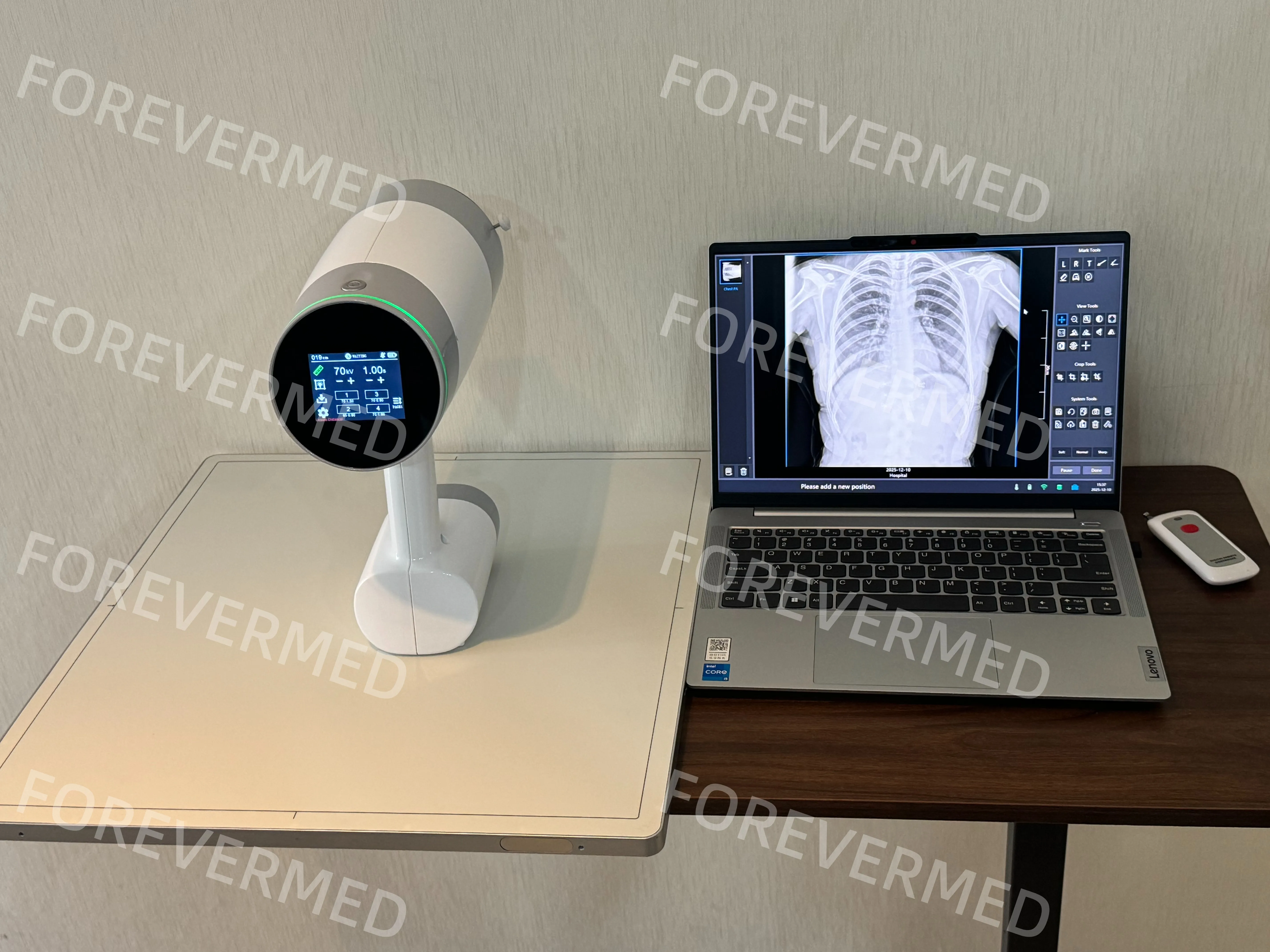 Upgraded Mini Xray 70kV 3mA Portable X-Ray Machine Handheld DR System Digital Xray Machine