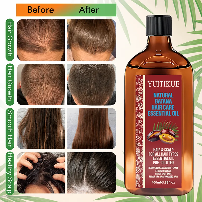 Óleo Essencial Natural de Bata - Hair Care Essential Oil Atomizing avaliação e preço