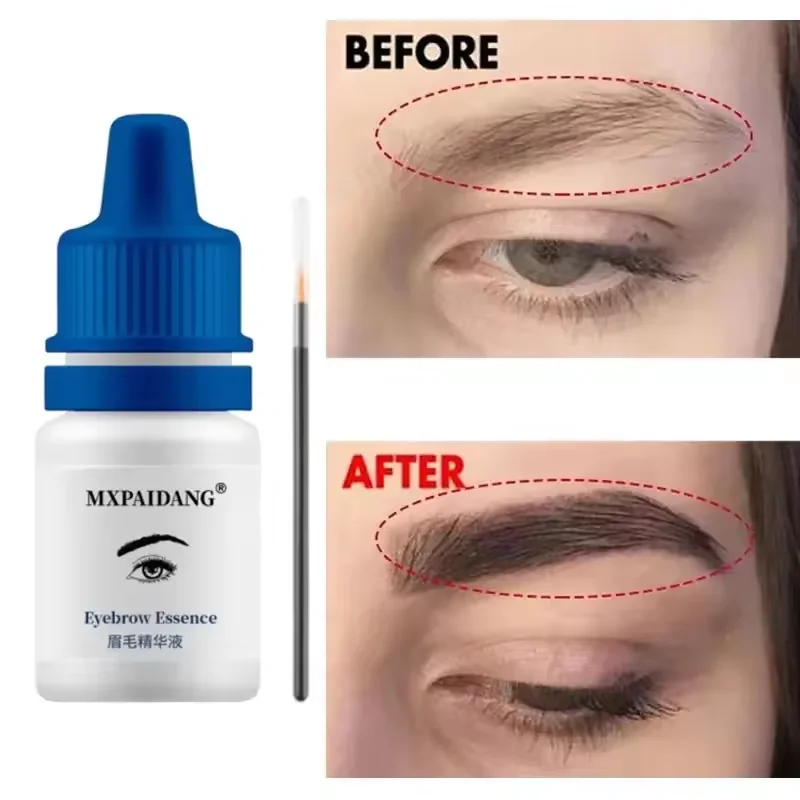 Soro de crescimento rápido de sobrancelha, crescimento de cílios, produto anti-perda de cabelo, prevenção de calvície, alongamento mais grosso, maquiagem de sobrancelha