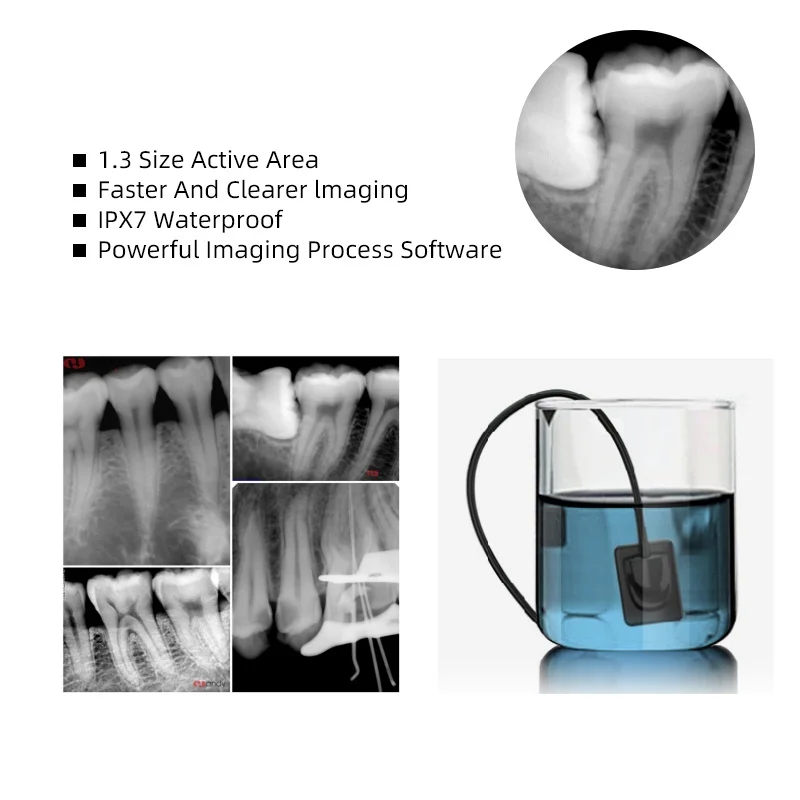 VVDental Handy X-ray Sensor USB Connection Computer  with IPX7 Waterproof Intraoral HD Imaging System Dentistry Clinic Equipment