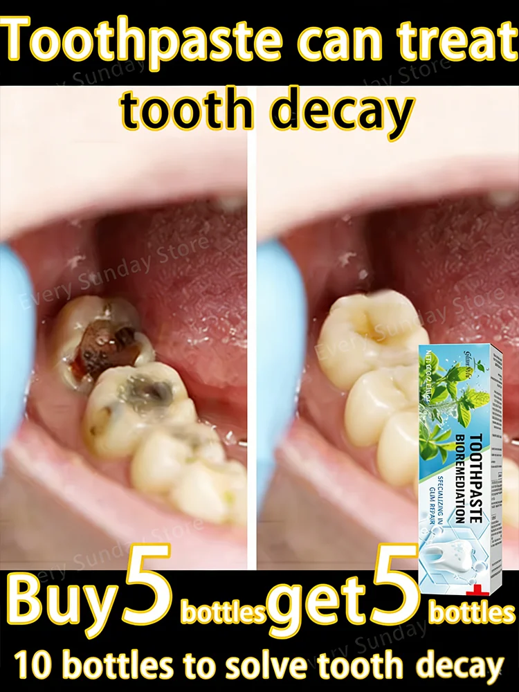 

Morning and evening use. Removes cavities, whitens teeth, and brightens teeth.