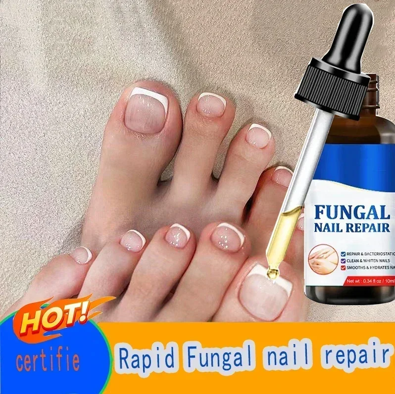 Anti Infection Toe Fungus Hand Foot Removal Repair oil Nail fungus treatment serum removal and repair of nail fungi