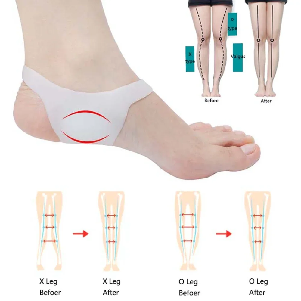 

Silicone Arch Support Orthopedic Insoles Foot Pads for Plantar Fasciitis Foot Valgus Varus Corrector Pain Relief Foot Care Tool