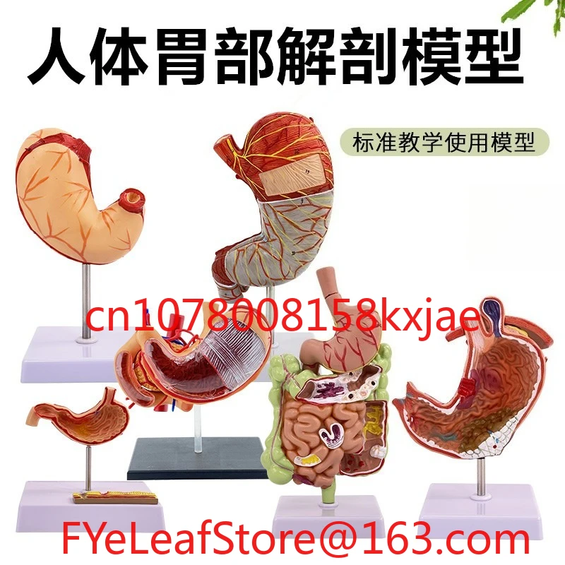 

Анатомическая модель желудка человека, модель поражения желудка