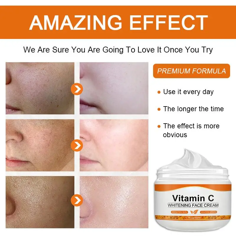 Crema facial con vitamina C, elimina manchas oscuras, blanqueamiento, cuidado, hidratante, antienvejecimiento, antiarrugas, reafirmante, cuidado de la piel, cosméticos