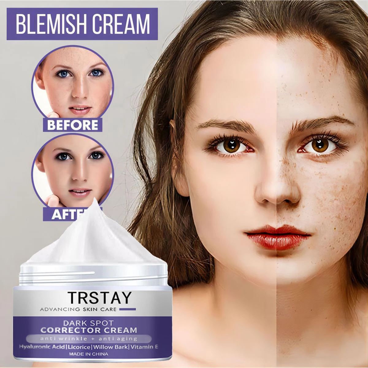 Moisturizing Freckle Cream Anti-Wrinkle Freckle Cream Shrink Pores Whitening Brightening Face Nourishing Skin Care Cream