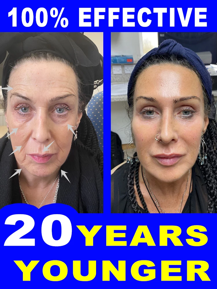 Reducing Wrinkles Restoring Smooth Skin