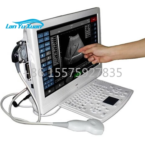 Touch Screen LCD Ultrasound Utouch-8