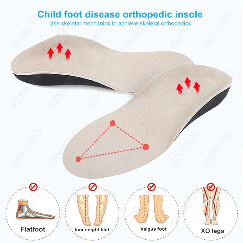 3D-Orthopädische Einlegesohlen für Plattfüße bei Kindern und Erwachsenen, Gewölbestütze für X-Beine, Orthopädische Schuh-Fersenpolster-Einlagen – Detail 8