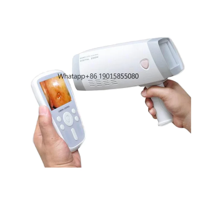 SUN-200Y Portable Handheld Gynecology Colposcopy System Digital Electronic Video for Women for Gynecology