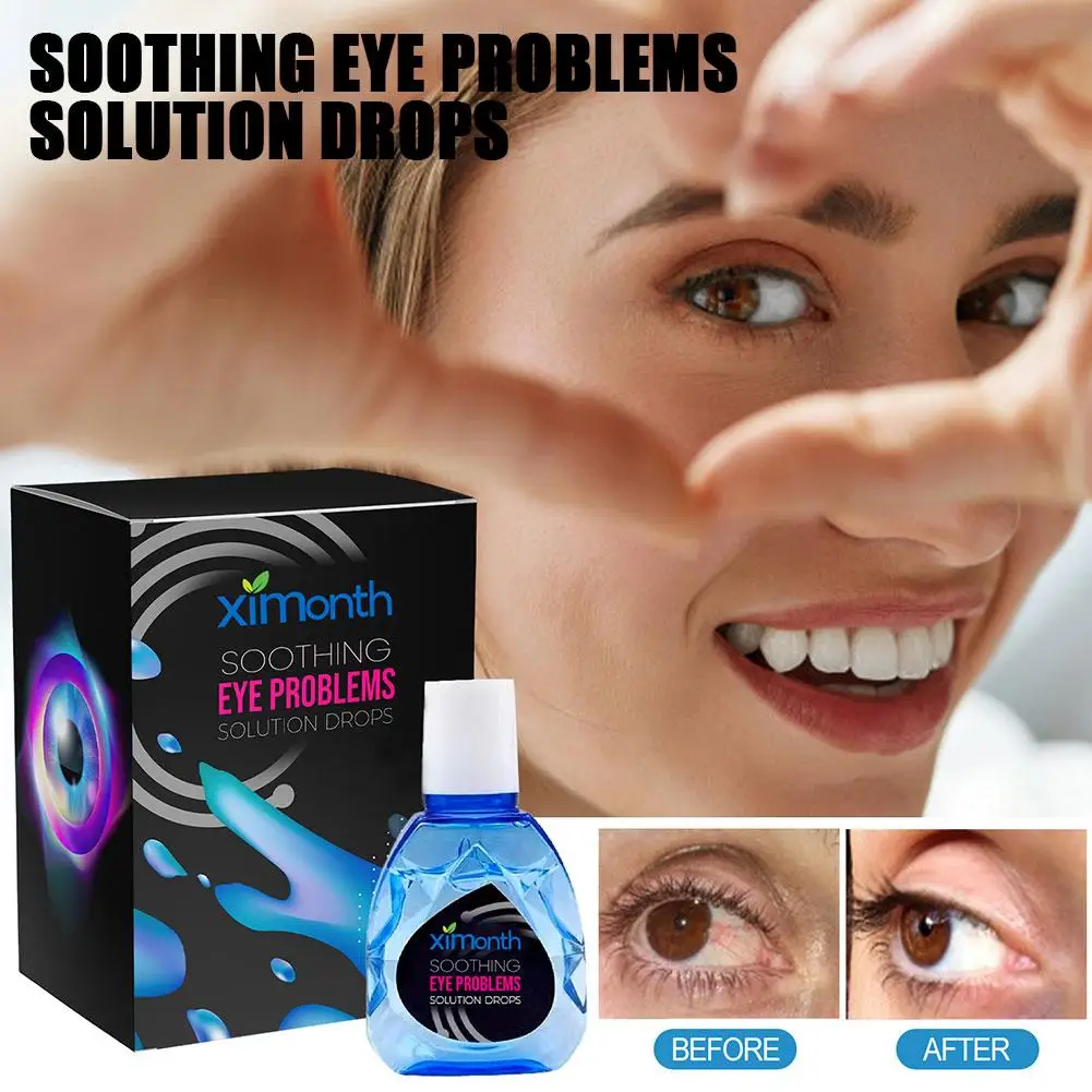 10ml Treatment EyeProblems SolutionDrops Eye Soothing Eye Drops Relieve Eye Circles Dark Improve Fatigue New Remove Eyesigh T9B8